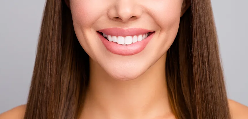 Hollywood Smile